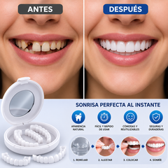 Carillas Dentales Premium — Sonrisa Perfecta al Instante