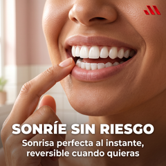 Carillas Dentales Premium — Sonrisa Perfecta al Instante